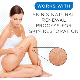 AmLactin Alpha Hydroxy Therapy Rapid Relief Restoring Lotion