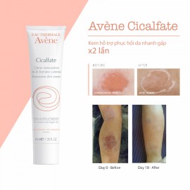 Avene Cicalfate Restorative Skin Cream