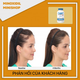 DrFormulas HairOmega DHT Blocker