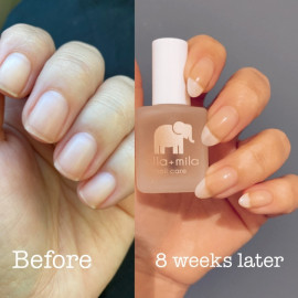 ella+mila First Aid Kiss Nail Strengthener