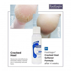 Footlogix Cracked Heel Formula