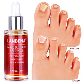 LANBENA NAIL REPAIR ESSENCE