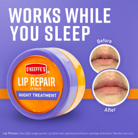O'Keeffee's Lip Repair