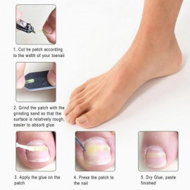 Dr. Scholls Ingrown Toenail Pain Reliever