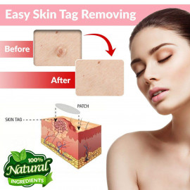 Greenland Products Skin Tag & Acne Remover Patches