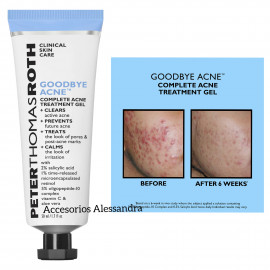 Peter Thomas Roth Goodbye Acne Complete Treatment Gel
