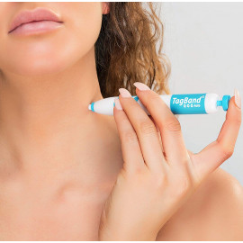 TagBand Skin Tag Remover Device